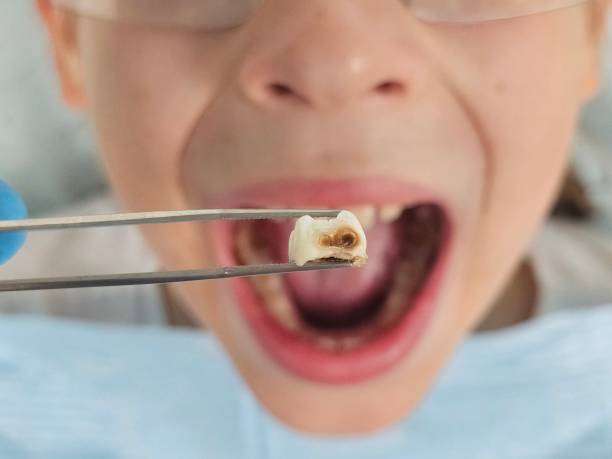 Best Emergency Broken Tooth Repair in Bruceton, TN